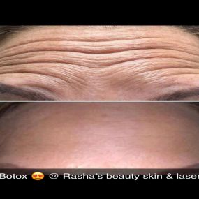 Bild von Rasha's Beauty Skin & Laser