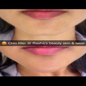 Bild von Rasha's Beauty Skin & Laser