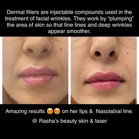 Bild von Rasha's Beauty Skin & Laser