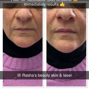 Bild von Rasha's Beauty Skin & Laser