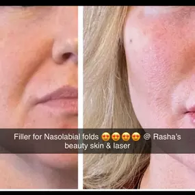 Bild von Rasha's Beauty Skin & Laser