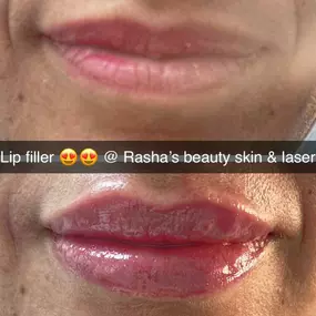 Bild von Rasha's Beauty Skin & Laser