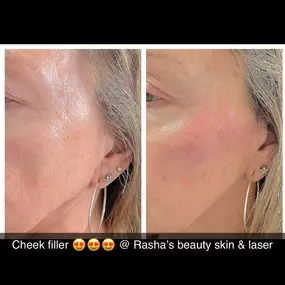 Bild von Rasha's Beauty Skin & Laser