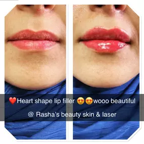 Bild von Rasha's Beauty Skin & Laser