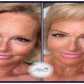 Bild von Restored Cosmetics (Medical Tattooing & Permanent Makeup)