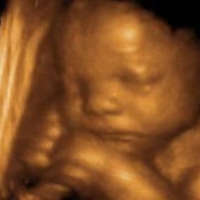 Bild von Fetal Memories 2D 3D 4D Ultrasound