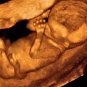 Bild von Fetal Memories 2D 3D 4D Ultrasound