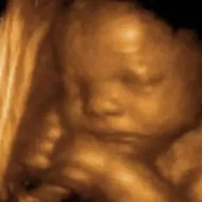 Bild von Fetal Memories 2D 3D 4D Ultrasound