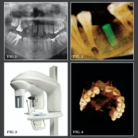 At New York Oral & Maxillofacial Surgery and Dental Implant Center, we are committed to remaining at the forefront of technology.  Our modern offices are fully outfitted with the latest, cutting-edge equipment, including a Cone Beam CT Scan, allowing us to perform a wide range of procedures safely and comfortably in our offices.  Our doctor and staff are skilled professionals dedicated to providing caring and compassionate service and a seamless patient experience.