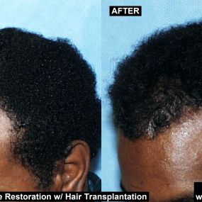 Bild von Dr. Alan J. Bauman - Bauman Medical Group Hair Transplant and Hair Loss Treatment Center