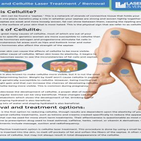 Bild von Laser Lipo and Vein Center