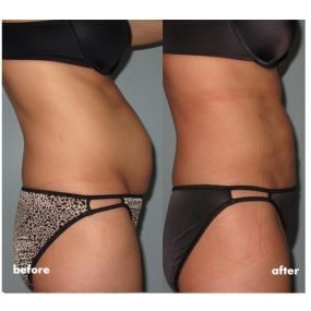 Bild von Laser Lipo and Vein Center