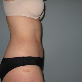 Bild von Laser Lipo and Vein Center