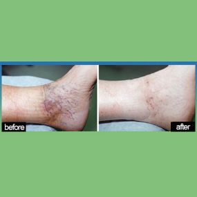 Bild von Laser Lipo and Vein Center