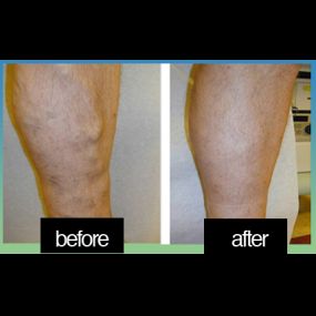 Bild von Laser Lipo and Vein Center