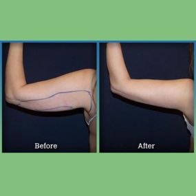 Bild von Laser Lipo and Vein Center