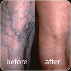 Bild von Laser Lipo and Vein Center