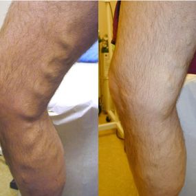 Bild von Laser Lipo and Vein Center