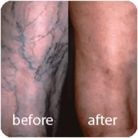 Bild von Laser Lipo and Vein Center