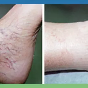 Bild von Laser Lipo and Vein Center