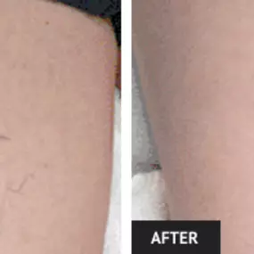 Bild von Laser Lipo and Vein Center