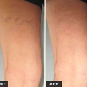 Bild von Laser Lipo and Vein Center