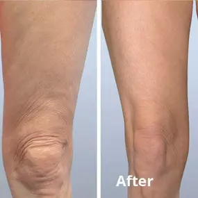 Bild von Laser Lipo and Vein Center