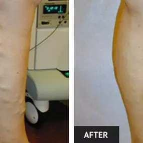 Bild von Laser Lipo and Vein Center