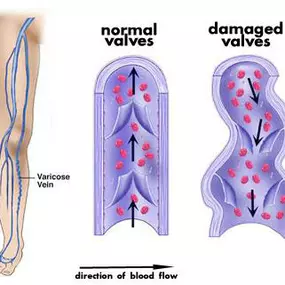 Bild von St Louis Laser Vein Center