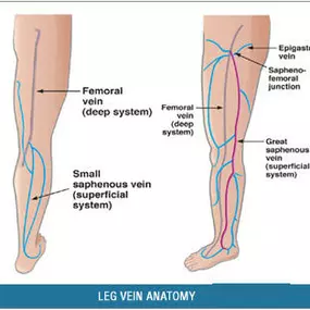 Bild von St Louis Laser Vein Center