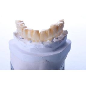centre-odontologia-miret-puig-maqueta-dental-03.jpg