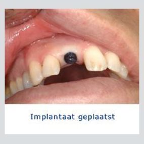 Kliniek voor Cosmetische Tandheelkunde Amsterdam Zuid