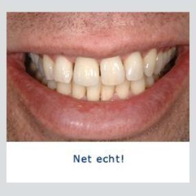 Kliniek voor Cosmetische Tandheelkunde Amsterdam Zuid
