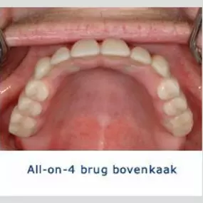 Kliniek voor Cosmetische Tandheelkunde Amsterdam Zuid