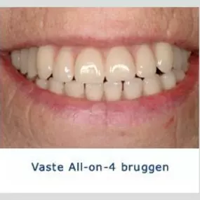 Kliniek voor Cosmetische Tandheelkunde Amsterdam Zuid