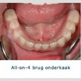 Kliniek voor Cosmetische Tandheelkunde Amsterdam Zuid