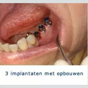 Kliniek voor Cosmetische Tandheelkunde Amsterdam Zuid