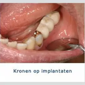 Kliniek voor Cosmetische Tandheelkunde Amsterdam Zuid