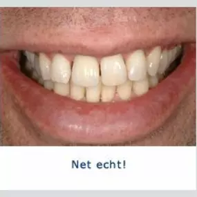 Kliniek voor Cosmetische Tandheelkunde Amsterdam Zuid