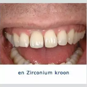 Kliniek voor Cosmetische Tandheelkunde Amsterdam Zuid