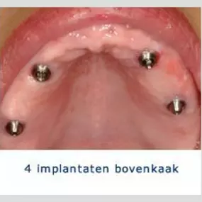 Kliniek voor Cosmetische Tandheelkunde Amsterdam Zuid