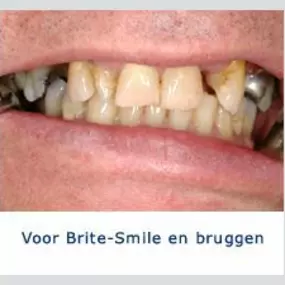 Kliniek voor Cosmetische Tandheelkunde Amsterdam Zuid