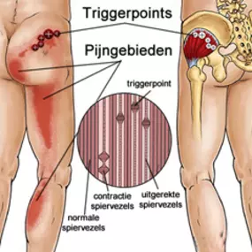 Bild von Schell Fysiotherapie Schouwen Duiveland