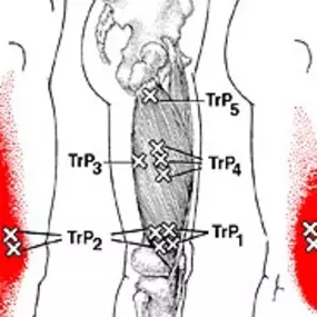 Bild von Schell Fysiotherapie Schouwen Duiveland