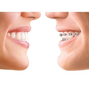 Bild von Associated Orthodontics Zanesville