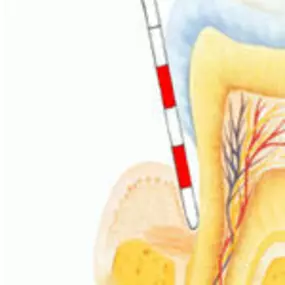 WestDent praktijk voor mondhygiëne