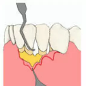 WestDent praktijk voor mondhygiëne