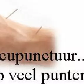 hand_erica_bernardus_acupunctu