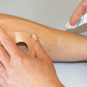 Medical Taping