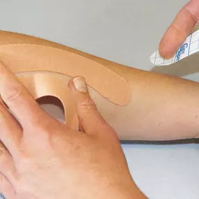 Medical Taping